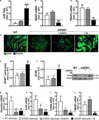 Recovery of Depleted miR-146a in ALS Cortical Astrocytes Reverts Cell Aberrancies and Prevents Paracrine Pathogenicity on Microglia and Motor Neurons